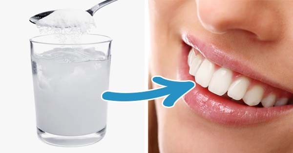 عکس از بین بردن بوی بد دهان و جرم دندان